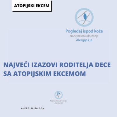 atopijski ekcem