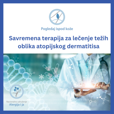 biološka terapia za lečenje atopijskog dermatitisa