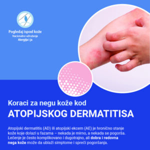 Koraci za negu kože kod atopijskog dermatitisa