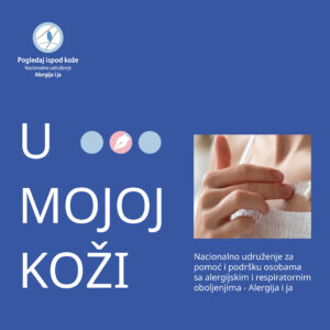 U mojoj koži